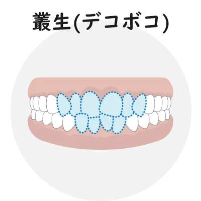 養生（デコボコ）